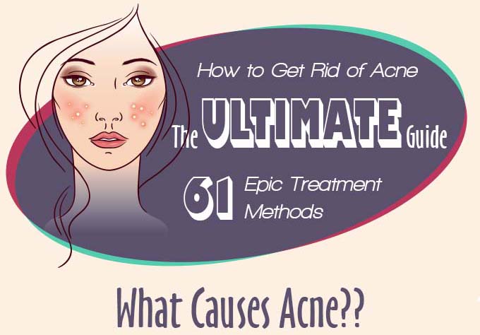 How To Get Rid of Acne: The Ultimate Guide